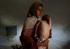 Un cuarto de los niños pequeños de Gaza sufren de malnutrición, afirma MSF