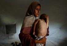 Un cuarto de los niños pequeños de Gaza sufren de malnutrición, afirma MSF