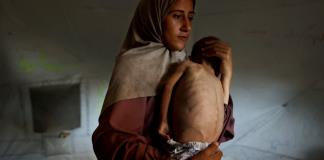 Un cuarto de los niños pequeños de Gaza sufren de malnutrición, afirma MSF