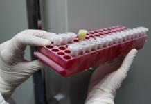Cada 30 segundos en el mundo muere una persona por algún tipo de hepatitis
