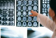 Un estudio apunta que tener un mayor nivel educativo no ralentiza el deterioro cognitivo
