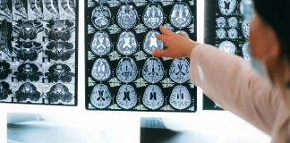 Un estudio apunta que tener un mayor nivel educativo no ralentiza el deterioro cognitivo