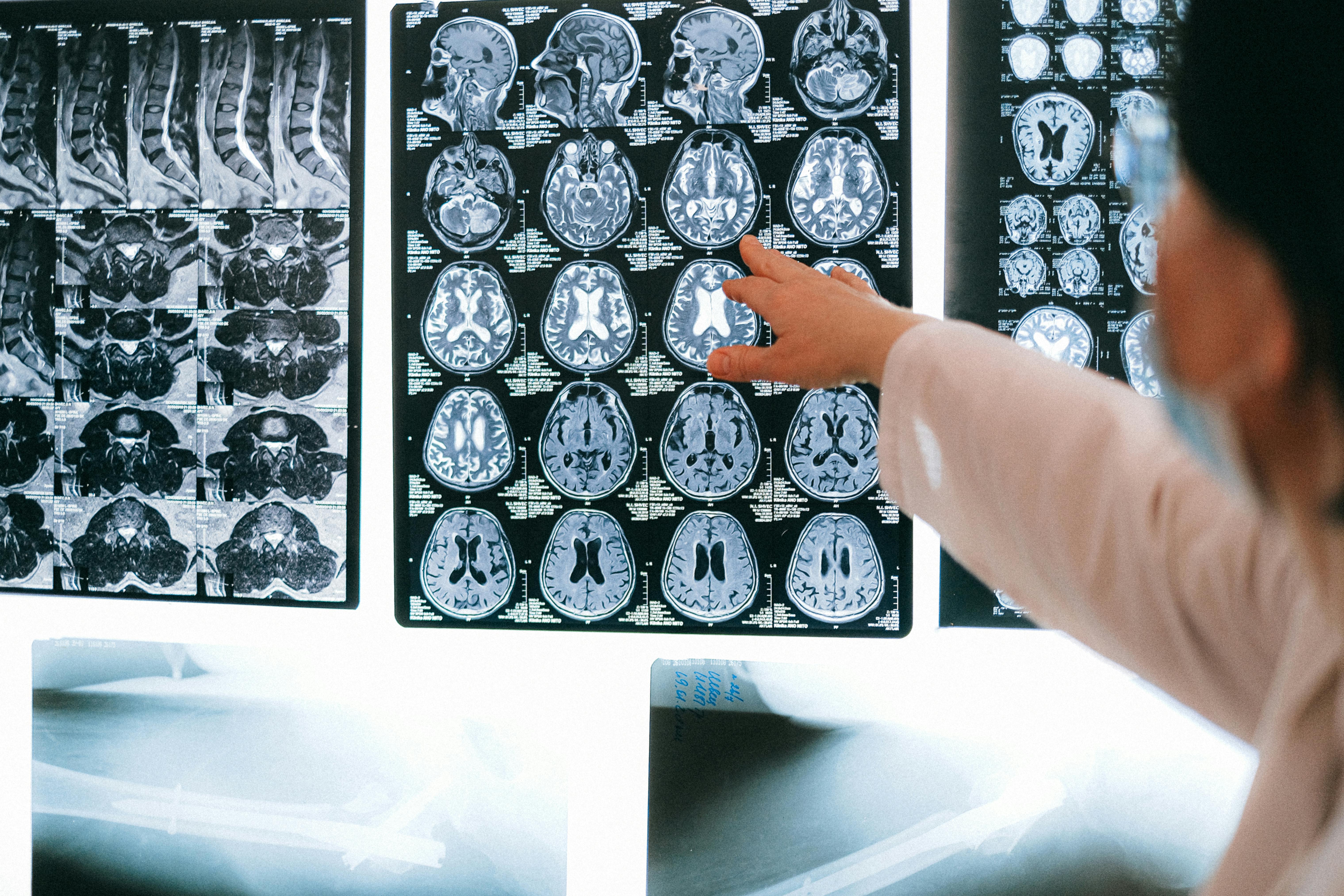 Un estudio apunta que tener un mayor nivel educativo no ralentiza el deterioro cognitivo