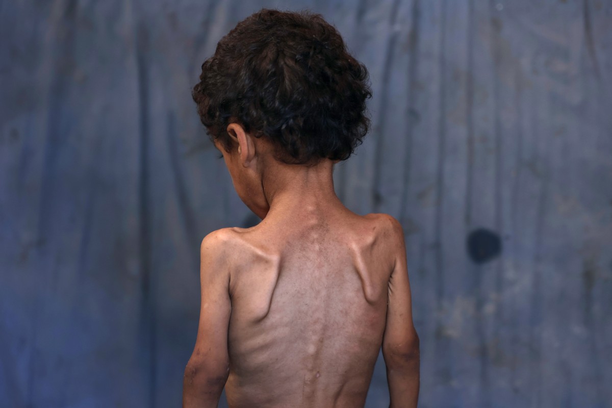 Un médico español tras volver de Gaza: es como si hubiera caído la bomba atómica Un médico español tras volver de Gaza: es como si hubiera caído la bomba atómica