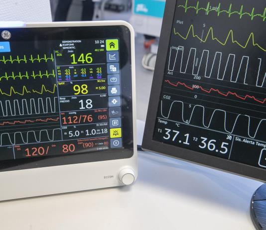 Las mujeres que sufren acoso en la pareja tienen más riesgo de padecer dolencias cardiacas