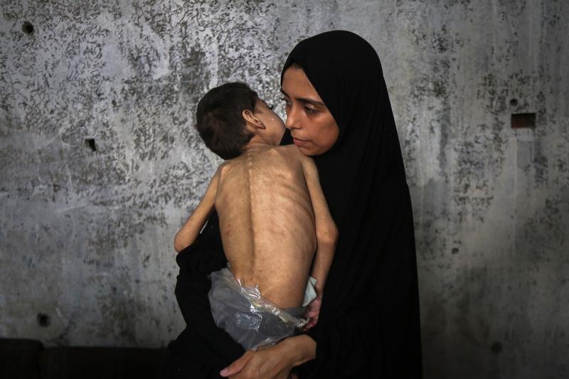 Sube a 227 número de muertes relacionadas con desnutrición en Gaza, dice ONU Sube a 227 número de muertes relacionadas con desnutrición en Gaza, dice ONU