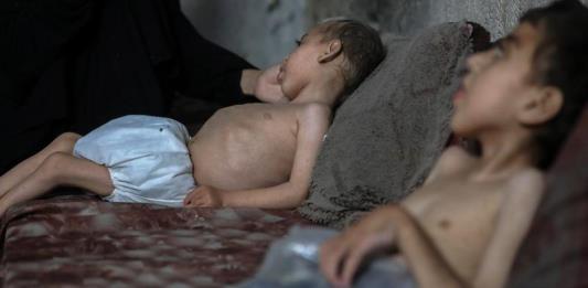 Sube a 227 número de muertes relacionadas con desnutrición en Gaza, dice ONU