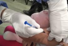 Las niñas, las más afectadas por el actual brote de sarampión en el país