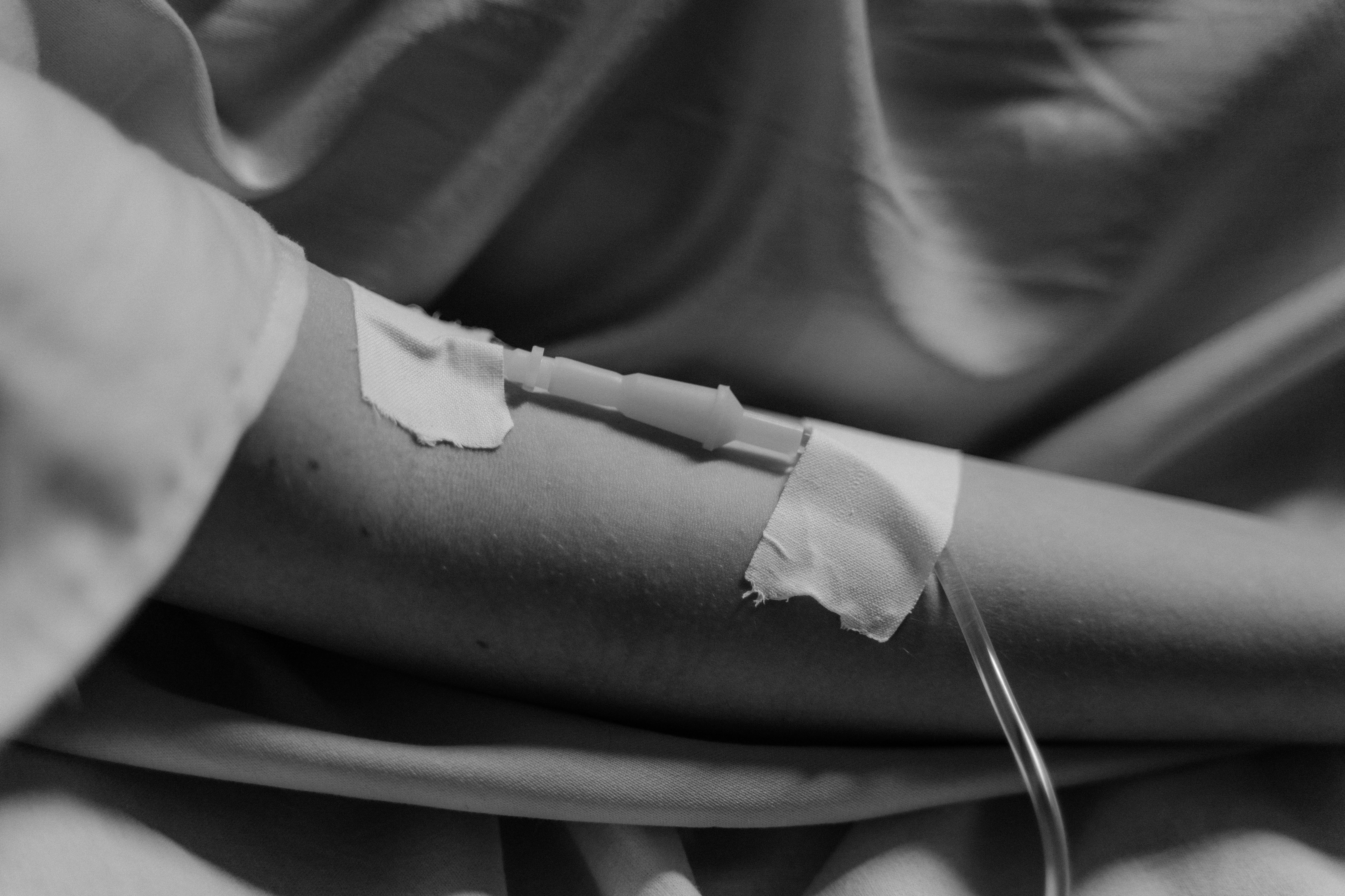Avances médicos han duplicado supervivencia de pacientes con mieloma múltiple en México Avances médicos han duplicado supervivencia de pacientes con mieloma múltiple en México