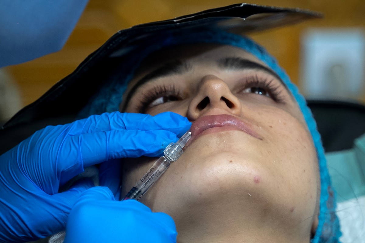 Bótox bajo el burka: las cirugías estéticas están de moda en Afganistán
