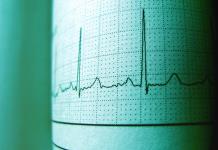 Científicos de EE.UU. crean una IA que busca prevenir infartos oyendo los latidos