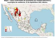 Ya suman nueve casos de sarampión en Jalisco 