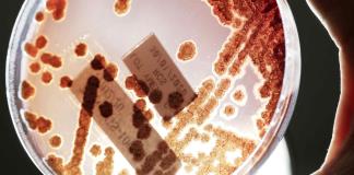 Aumentan en Estados Unidos las infecciones por bacterias resistentes a los antibióticos