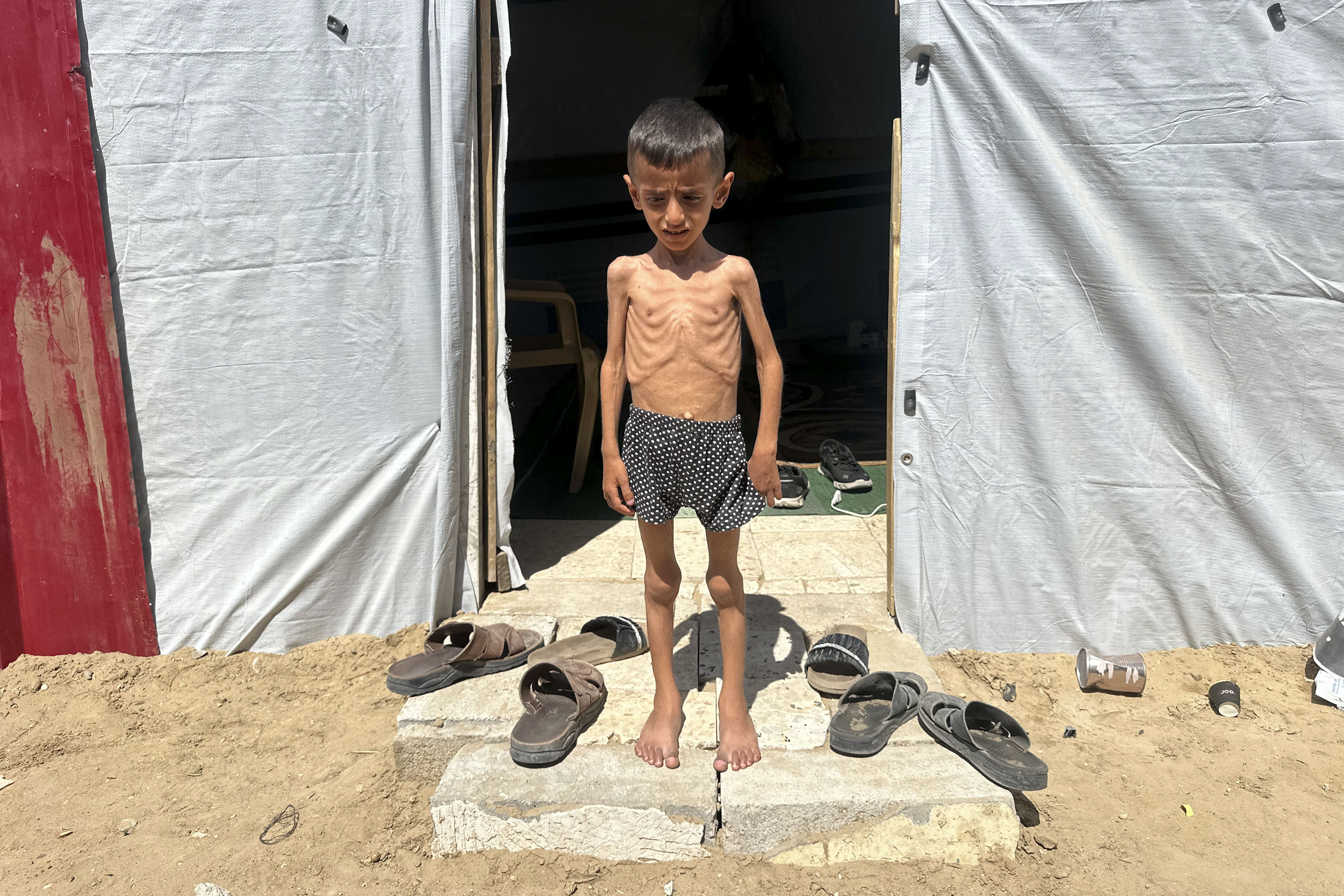 Gaza al límite, se acaba el tiempo para los niños de la hambruna.