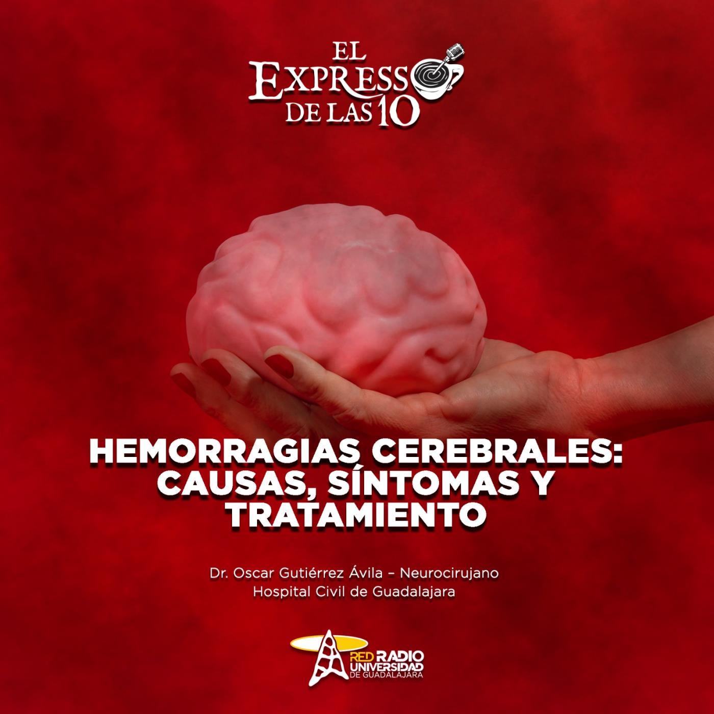 Hemorragias cerebrales: Causas, síntomas y tratamiento - El Expresso de las 10 - Ma. 30 Septiembre 2025