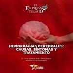 Hemorragias cerebrales: Causas, síntomas y tratamiento - El Expresso de las 10 - Ma. 30 Septiembre 2025