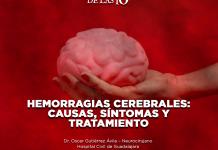 Hemorragias cerebrales: Causas, síntomas y tratamiento - El Expresso de las 10 - Ma. 30 Septiembre 2025