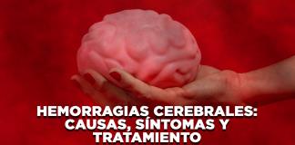 Hemorragias cerebrales: Causas, síntomas y tratamiento - El Expresso de las 10 - Ma. 30 Septiembre 2025
