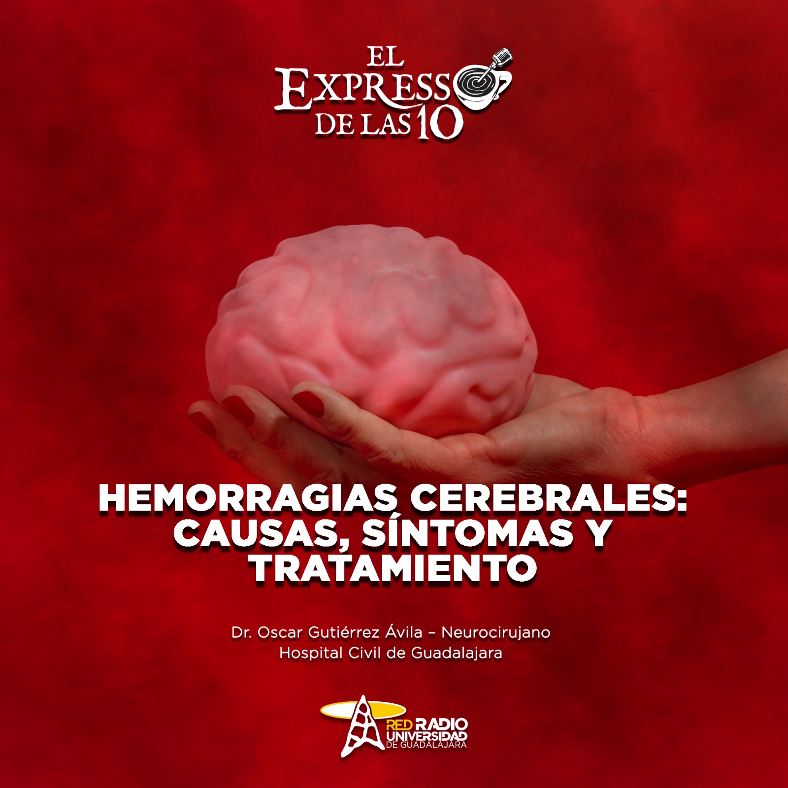 Hemorragias cerebrales: Causas, síntomas y tratamiento - El Expresso de las 10 - Ma. 30 Septiembre 2025 Hemorragias cerebrales: Causas, síntomas y tratamiento - El Expresso de las 10 - Ma. 30 Septiembre 2025