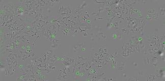 Descubren un mecanismo bacteriano que podría destruir células tumorales