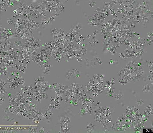 Descubren un mecanismo bacteriano que podría destruir células tumorales