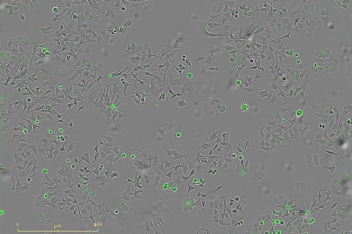 Descubren un mecanismo bacteriano que podría destruir células tumorales Descubren un mecanismo bacteriano que podría destruir células tumorales
