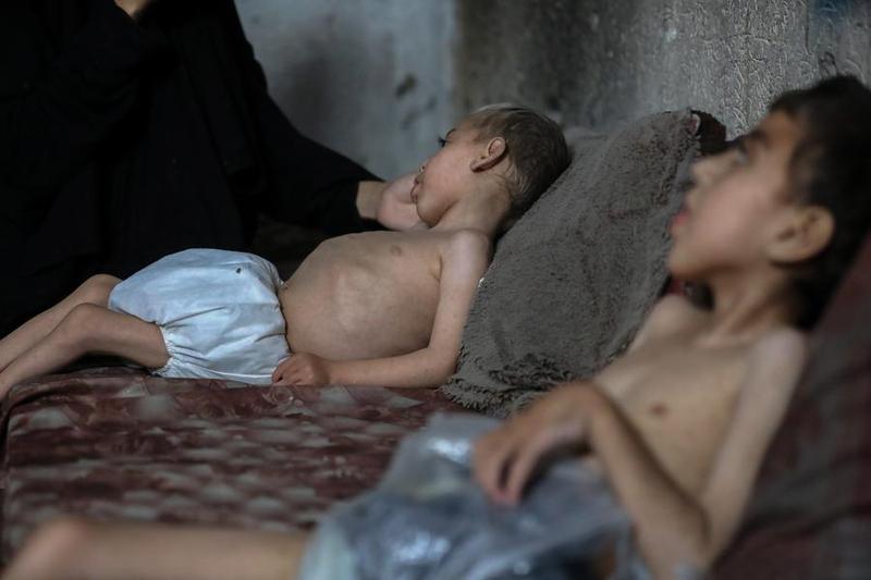 Más de 54.600 niños gazatíes sufren desnutrición severa, 12.800 muy grave Más de 54.600 niños gazatíes sufren desnutrición severa, 12.800 muy grave
