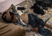 Más de 54.600 niños gazatíes sufren desnutrición severa, 12.800 muy grave