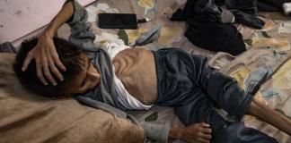 Más de 54.600 niños gazatíes sufren desnutrición severa, 12.800 muy grave