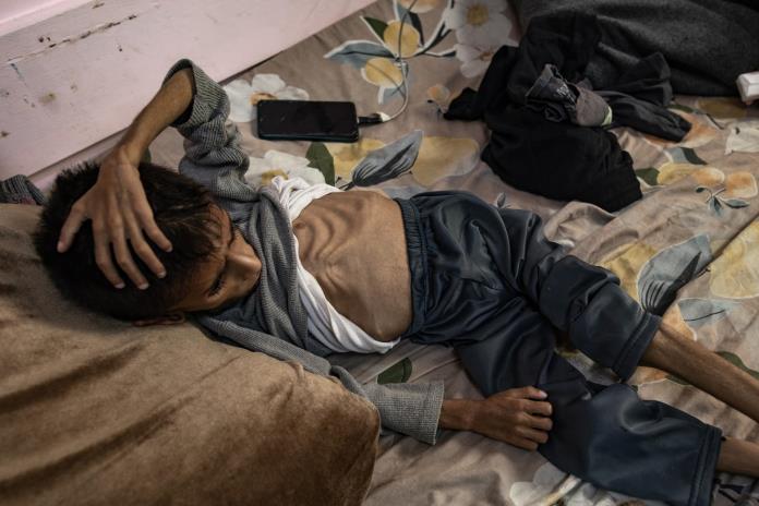 Más de 54.600 niños gazatíes sufren desnutrición severa, 12.800 muy grave Más de 54.600 niños gazatíes sufren desnutrición severa, 12.800 muy grave