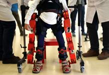 Unas 500 millones de personas en el mundo padecen osteoporosis sin saberlo