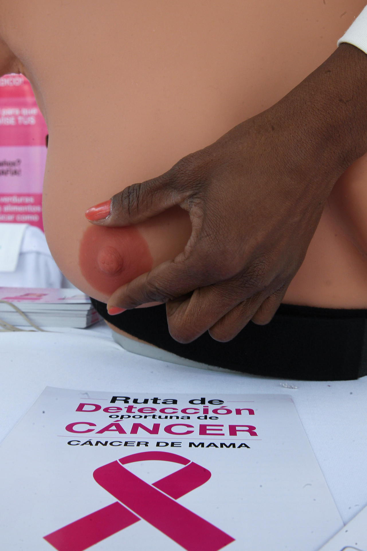 Expertos alertan sobre la falta de registros de cáncer de mama en América Latina Expertos alertan sobre la falta de registros de cáncer de mama en América Latina