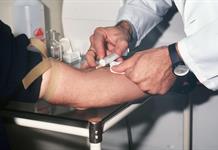 Un análisis genético podría detectar el párkinson antes de los primeros síntomas Un análisis genético podría detectar el párkinson antes de los primeros síntomas