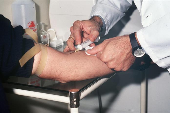 Un análisis genético podría detectar el párkinson antes de los primeros síntomas Un análisis genético podría detectar el párkinson antes de los primeros síntomas