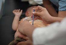 Jalisco suma un nuevo caso de sarampión; registra 137 contagios y se mantiene en segundo lugar nacional Jalisco suma un nuevo caso de sarampión; registra 137 contagios y se mantiene en segundo lugar nacional