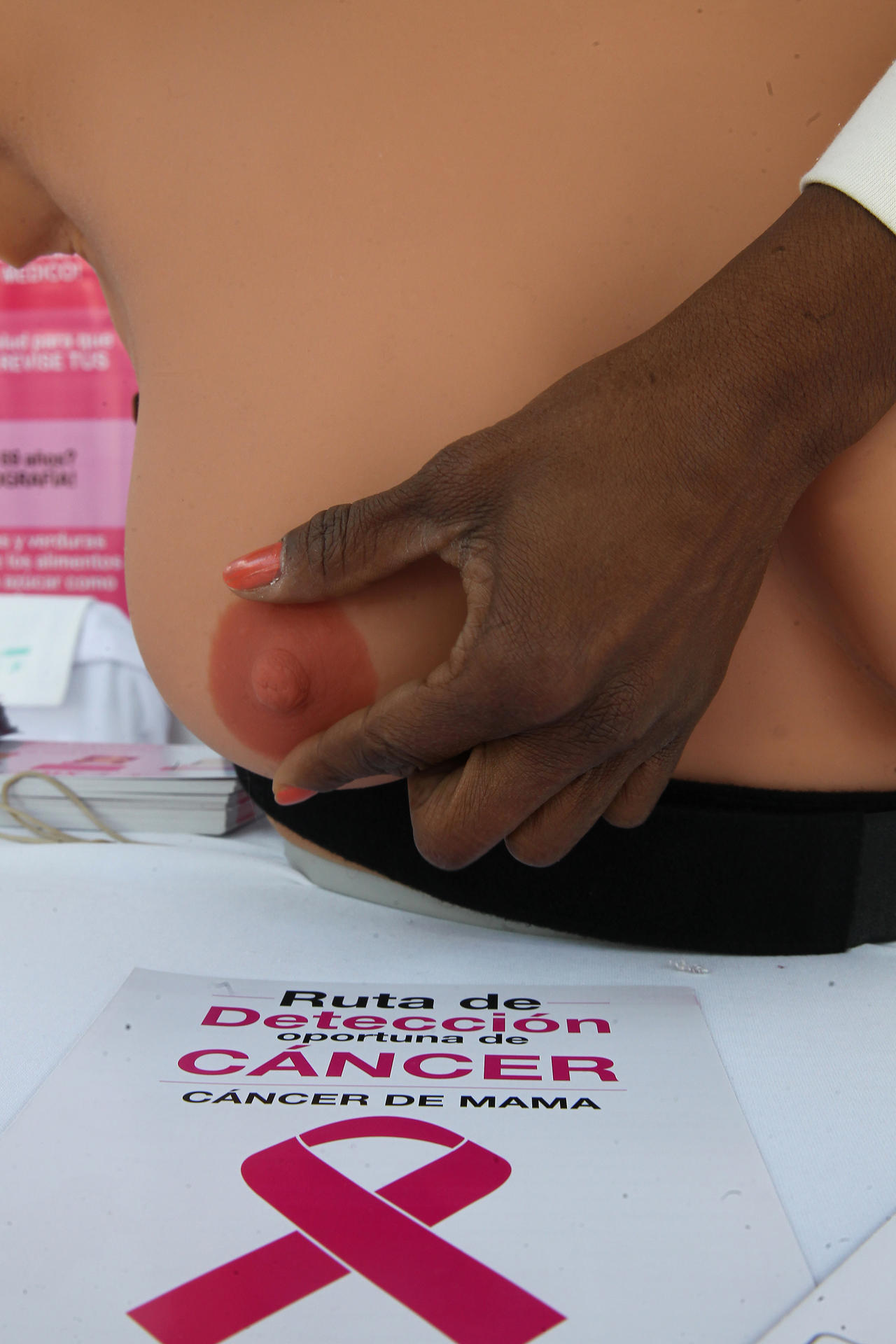 OMS impulsa el diagnóstico en menos de 60 días para reducir mortalidad por cáncer de mama