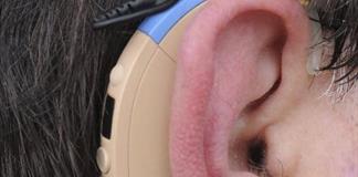 Una campaña en México busca combatir el estigma que rodea a los auxiliares auditivos