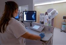 OMS impulsa el diagnóstico en menos de 60 días para reducir mortalidad por cáncer de mama