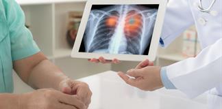 El cáncer de pulmón es la neoplasia más letal en el mundo y necesita “detección temprana” El cáncer de pulmón es la neoplasia más letal en el mundo y necesita “detección temprana”