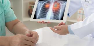 Analizan la relaci&oacute;n entre los contaminantes del aire y los subtipos de c&aacute;ncer de pulm&oacute;n