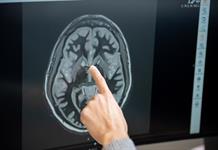 Tirzepatida reduce deseo de comer según investigación Tirzepatida reduce deseo de comer según investigación