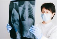 Identifican una proteína que 