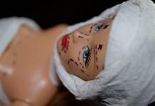 Durango aprueba ley Nicole para prohibir cirugías estéticas en menores Durango aprueba ley Nicole para prohibir cirugías estéticas en menores