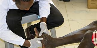 Como si me comiera desde dentro: la enfermedad que ataca los huesos en el norte de Kenia Como si me comiera desde dentro: la enfermedad que ataca los huesos en el norte de Kenia