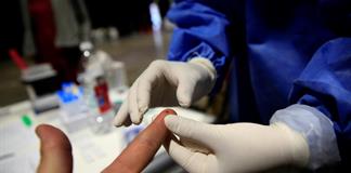 Nueva técnica revoluciona detección temprana del Alzheimer