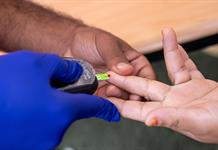 La diabetes mellitus costar&aacute; globalmente m&aacute;s de 152 billones de d&oacute;lares hasta el a&ntilde;o 2050