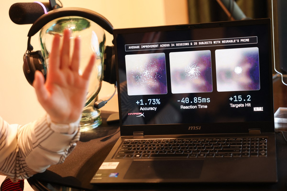 La IA impulsa una nueva era de autoanálisis médico