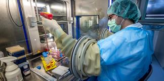 CHUV intensifica producci&oacute;n de piel para atender grandes quemados en Suiza