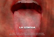 La Lengua - El Expresso de las 10 - Ma. 20 Enero 2026