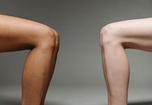 Médicos de Mundo pide formar a los sanitarios para prevenir la mutilación genital femenina